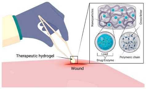  Ketoconazole-Loaded Hydrogel for Enhanced Drug Delivery and Wound Healing!