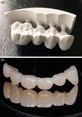  Zirconia: Il Re del Resistore e la Giostra dell'Impianto Dentale!